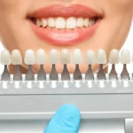 Cosmetic dentistry Hero image