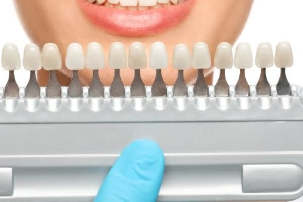Cosmetic dentistry image