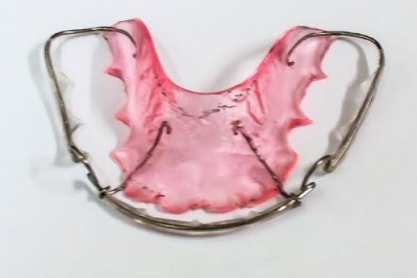 REMOVABLE BEGG RETAINER
