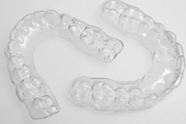 REMOVABLE CLEAR ESSIX RETAINER
