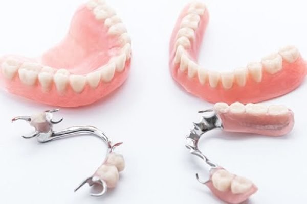 dental denture image