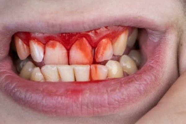 dental emergency image